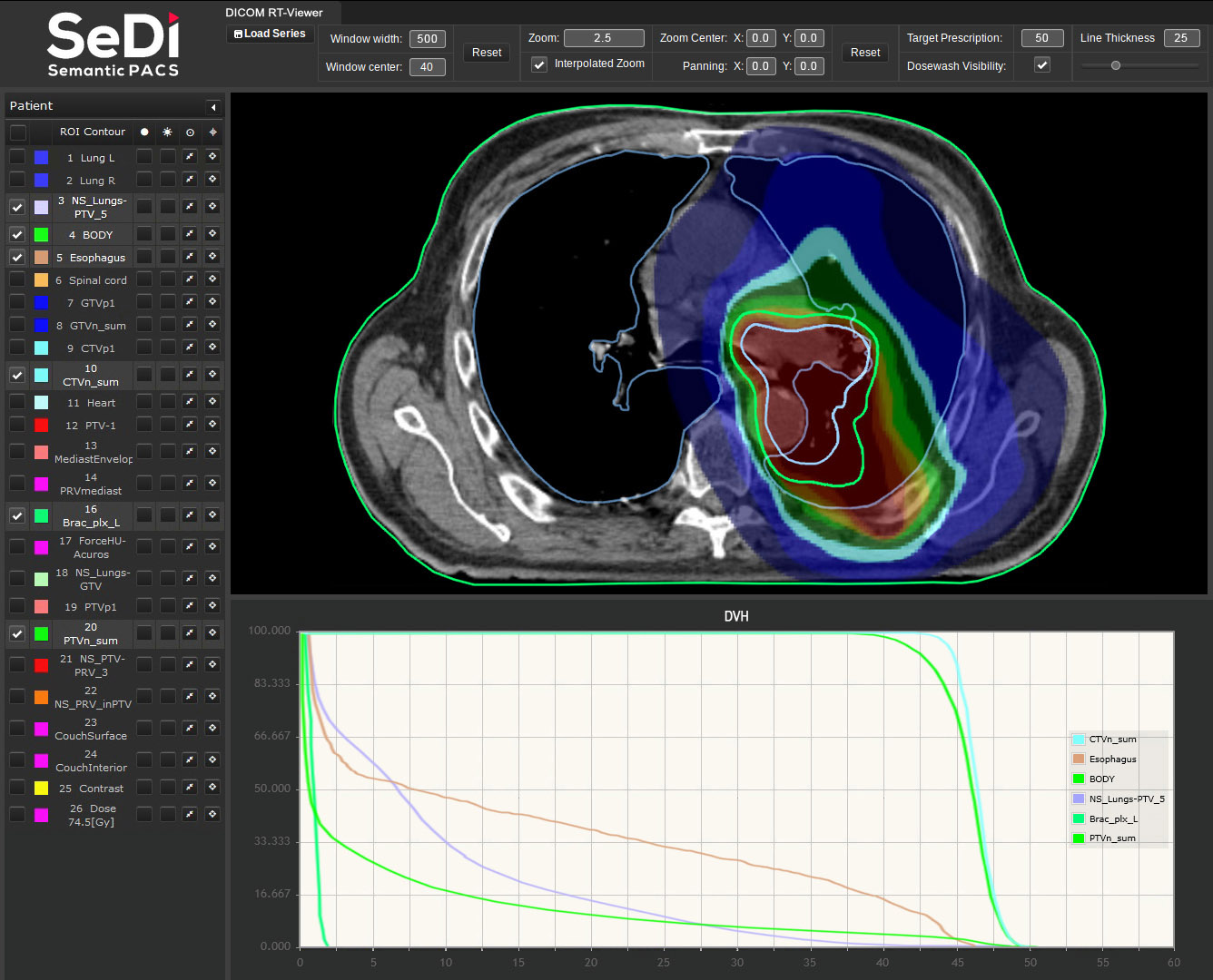 Dicom viewer